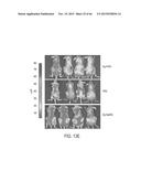 FUCOIDAN NANOGELS AND METHODS OF THEIR USE AND MANUFACTURE diagram and image