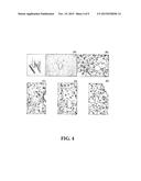 NASAL VACCINE AGAINST THE DEVELOPMENT OF ATHEROSCLEROSIS DISEASE AND FATTY     LIVER diagram and image