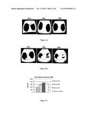 POROUS POLYSACCHARIDE SCAFFOLD COMPRISING NANO-HYDROXYAPATITE AND USE FOR     BONE FORMATION diagram and image