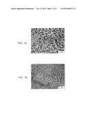 METHOD OF INHIBITING THICKENING OF VASCULAR INTIMA diagram and image