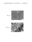 METHOD OF INHIBITING THICKENING OF VASCULAR INTIMA diagram and image