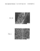 METHOD OF INHIBITING THICKENING OF VASCULAR INTIMA diagram and image