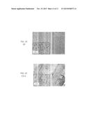 METHOD OF INHIBITING THICKENING OF VASCULAR INTIMA diagram and image