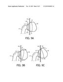 MOTION STABILIZER SYSTEM FOR RESPIRATORY INTERFACE DEVICE diagram and image