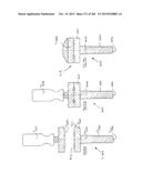 DEVICE FOR AND METHOD OF CONNECTING TWO ITEMS TOGETHER diagram and image