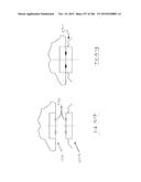 DEVICE FOR AND METHOD OF CONNECTING TWO ITEMS TOGETHER diagram and image