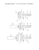 DEVICE FOR AND METHOD OF CONNECTING TWO ITEMS TOGETHER diagram and image