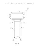 STOPPER REMOVER diagram and image