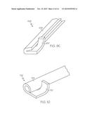 STOPPER REMOVER diagram and image