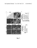 NOVEL DIAGNOSTIC AND THERAPEUTIC TARGET IN INFLAMMATORY AND/OR     CARDIOVASCULAR DISEASES diagram and image