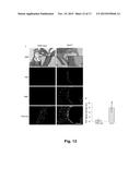 NOVEL DIAGNOSTIC AND THERAPEUTIC TARGET IN INFLAMMATORY AND/OR     CARDIOVASCULAR DISEASES diagram and image