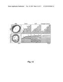 NOVEL DIAGNOSTIC AND THERAPEUTIC TARGET IN INFLAMMATORY AND/OR     CARDIOVASCULAR DISEASES diagram and image