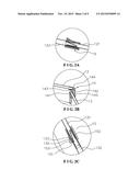 TENT diagram and image