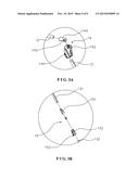 TENT diagram and image