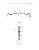 TENT diagram and image