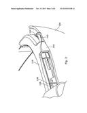 TTL ADJUSTABLE BINOCULAR LOUPES DEVICE diagram and image