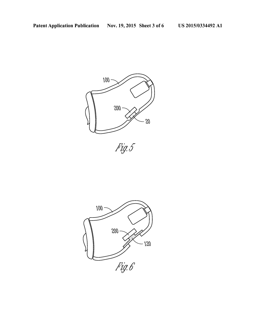 METHOD AND APPARATUS FOR OWN-VOICE SENSING IN A HEARING ASSISTANCE DEVICE - diagram, schematic, and image 04