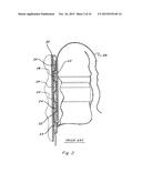 Light Weight Modular Pouch Attachment System And Method diagram and image