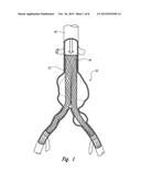 STENT GRAFT MONITORING ASSEMBLY AND METHOD OF USE THEREOF diagram and image