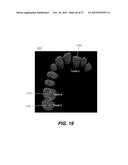 METHOD FOR TEETH SEGMENTATION AND ALIGNMENT DETECTION IN CBCT VOLUME diagram and image