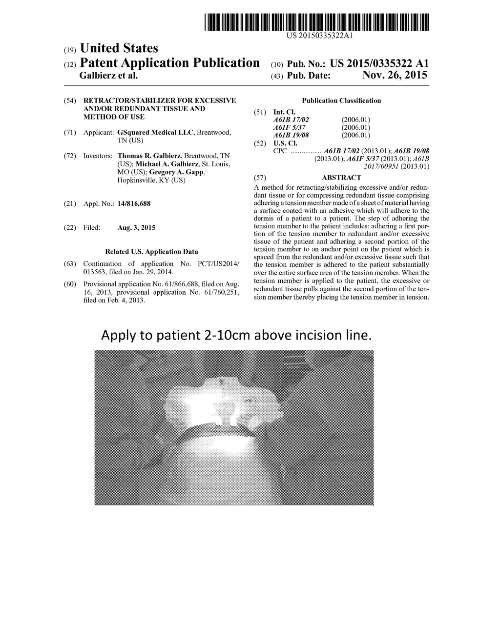 RETRACTOR/STABILIZER FOR EXCESSIVE AND/OR REDUNDANT TISSUE AND METHOD OF     USE - diagram, schematic, and image 01