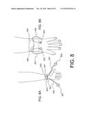 APPARATUS AND METHOD TO STOP BLEEDING diagram and image