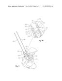 ACETABULAR DRILL PIN diagram and image