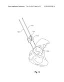 ACETABULAR DRILL PIN diagram and image