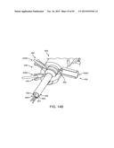 TISSUE RESECTION AND TREATMENT WITH SHEDDING PULSES diagram and image