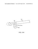 TISSUE RESECTION AND TREATMENT WITH SHEDDING PULSES diagram and image