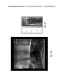 TISSUE RESECTION AND TREATMENT WITH SHEDDING PULSES diagram and image