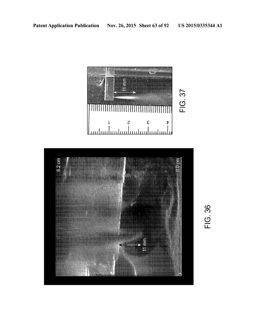 TISSUE RESECTION AND TREATMENT WITH SHEDDING PULSES - diagram, schematic, and image 64