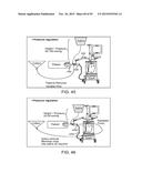 TISSUE RESECTION AND TREATMENT WITH SHEDDING PULSES diagram and image