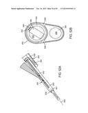 TISSUE RESECTION AND TREATMENT WITH SHEDDING PULSES diagram and image