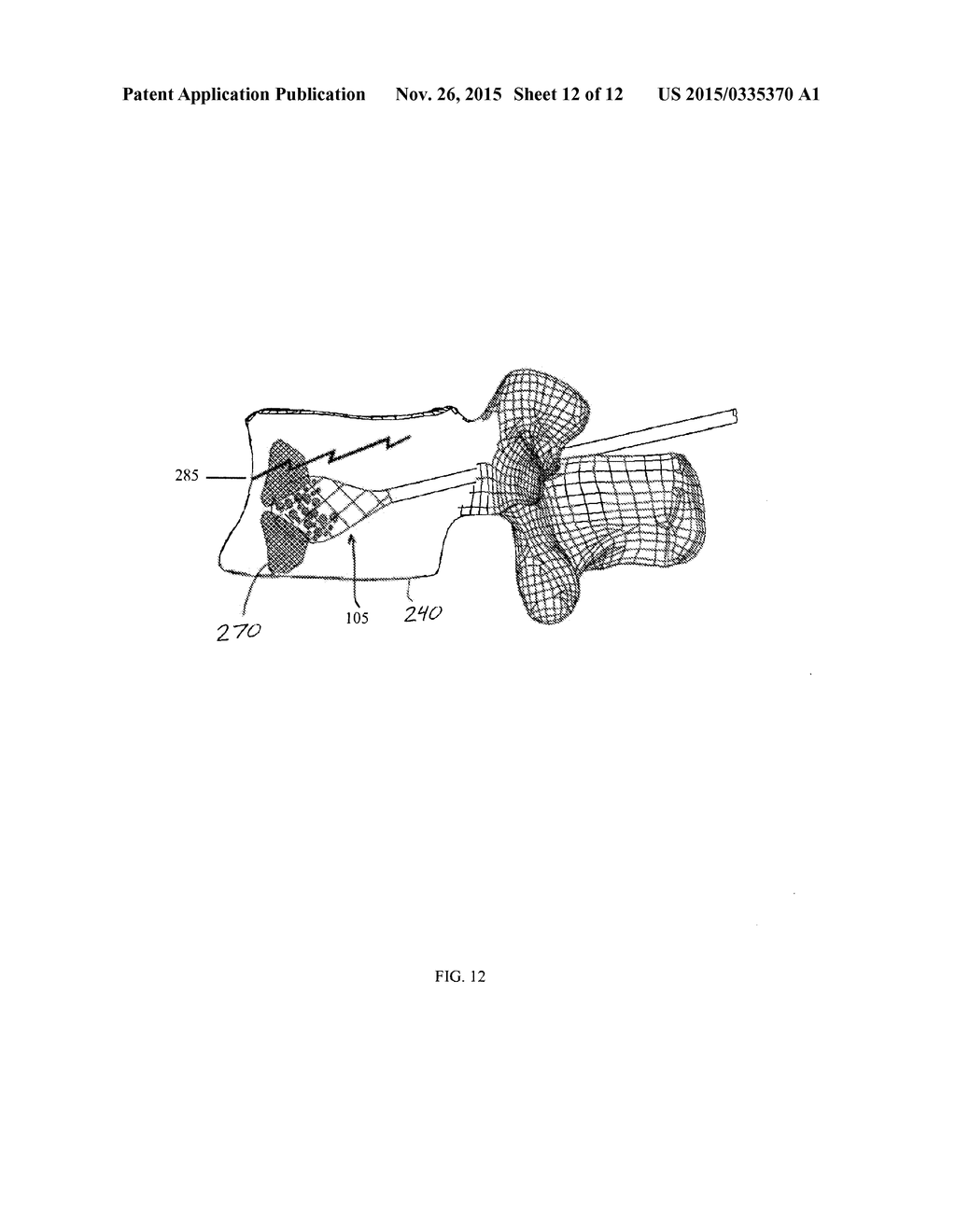 BALLOON EXPANDABLE CEMENT DIRECTOR AND RELATED METHODS - diagram, schematic, and image 13