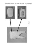 TOOTH SCAFFOLDS diagram and image