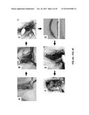 TOOTH SCAFFOLDS diagram and image