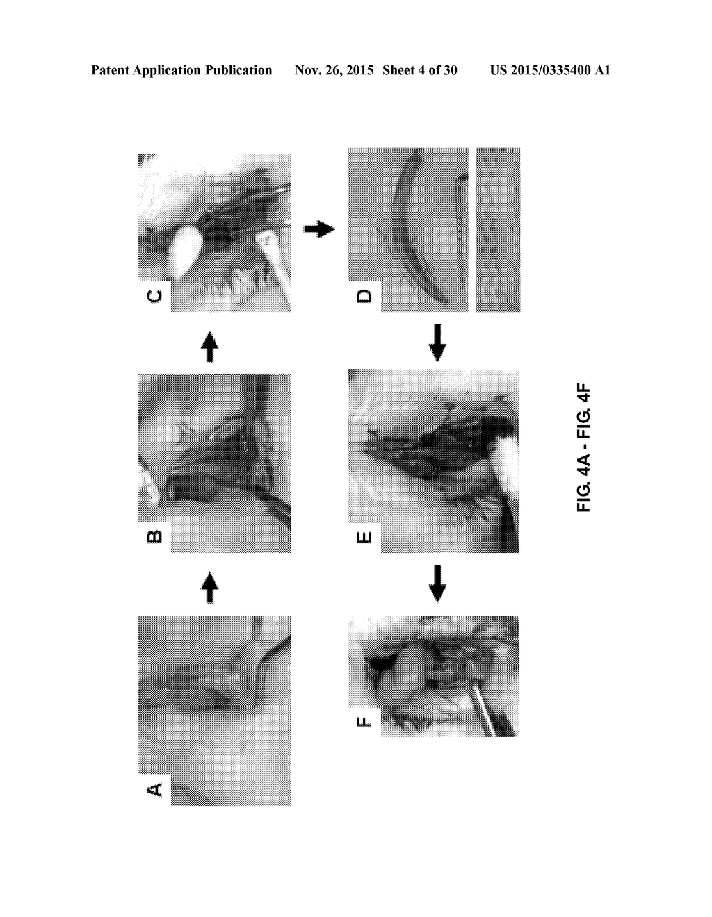 TOOTH SCAFFOLDS - diagram, schematic, and image 05