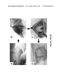 TOOTH SCAFFOLDS diagram and image