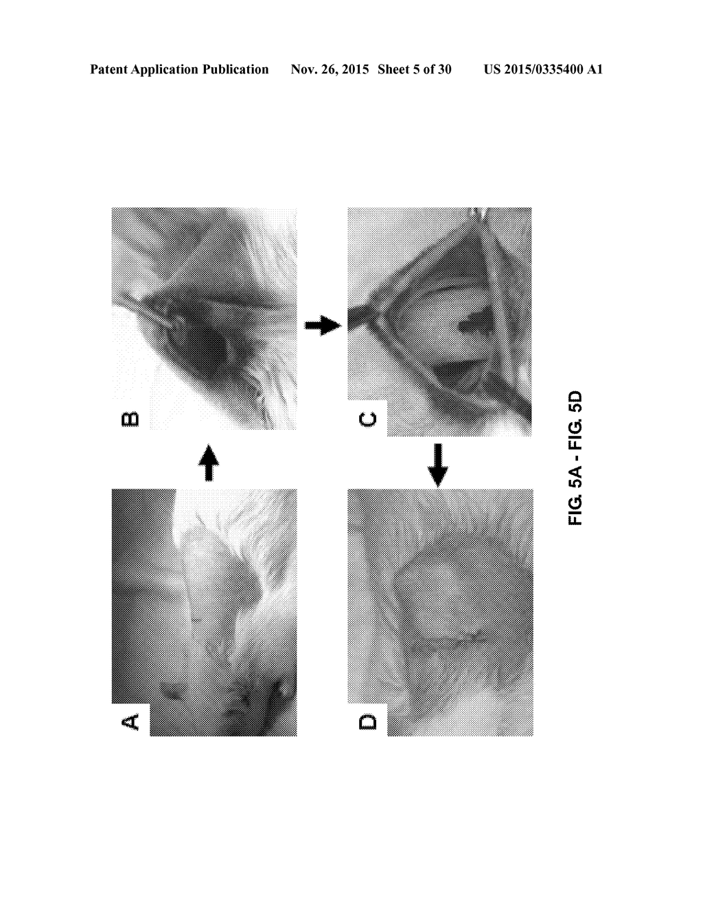 TOOTH SCAFFOLDS - diagram, schematic, and image 06