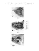 TOOTH SCAFFOLDS diagram and image