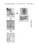 TOOTH SCAFFOLDS diagram and image