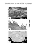 TOOTH SCAFFOLDS diagram and image