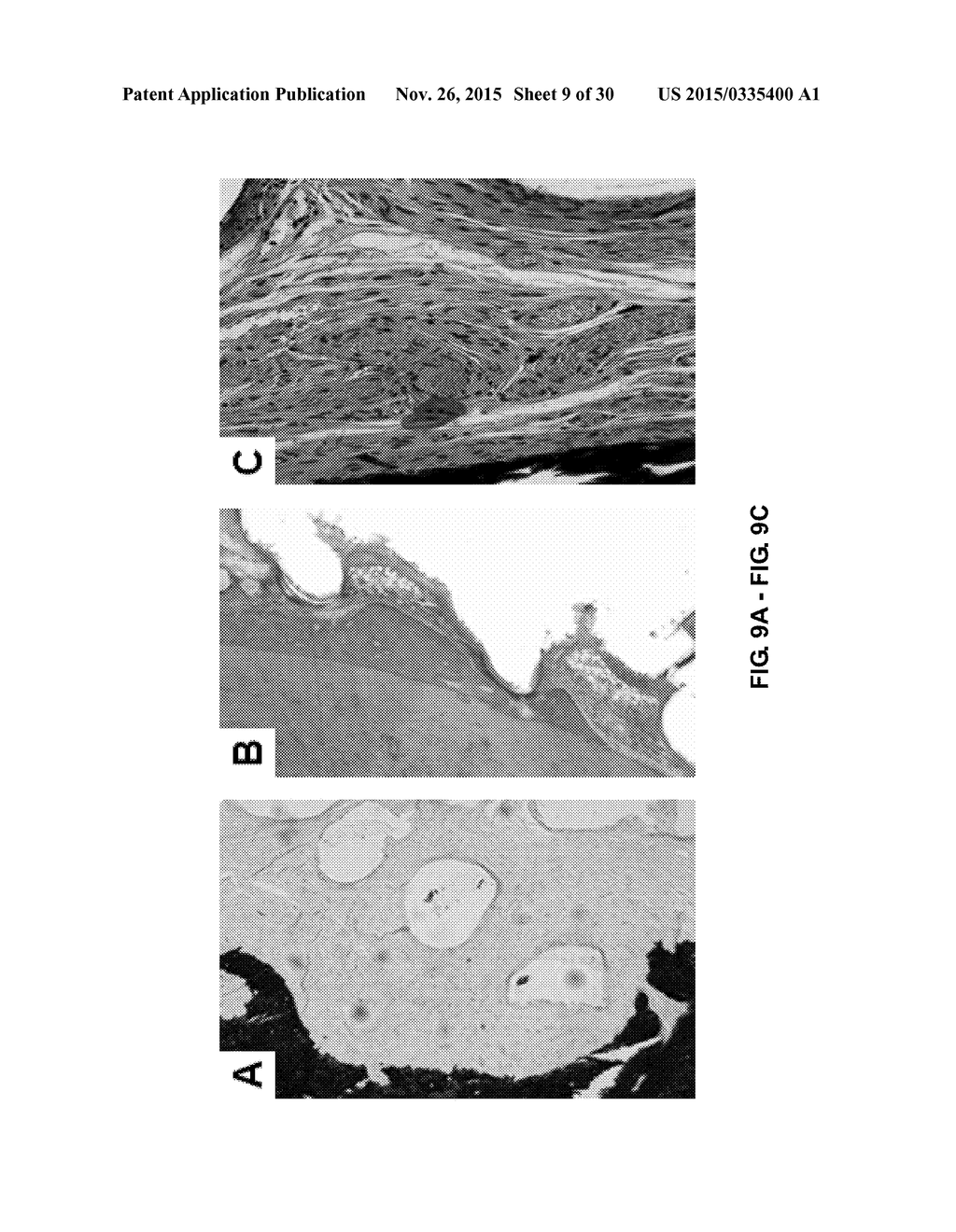 TOOTH SCAFFOLDS - diagram, schematic, and image 10