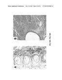 TOOTH SCAFFOLDS diagram and image