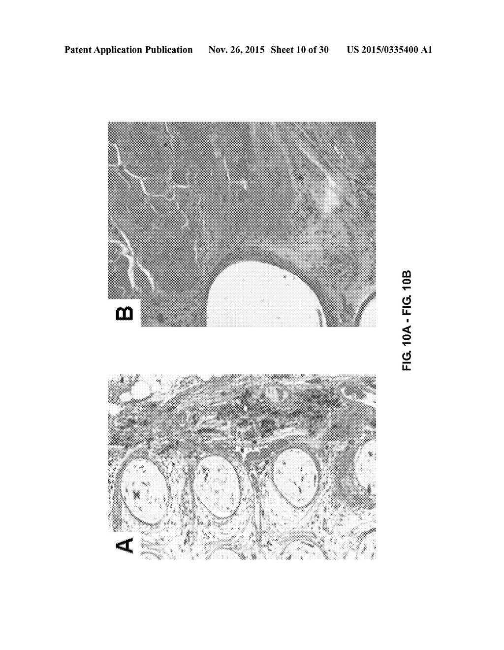 TOOTH SCAFFOLDS - diagram, schematic, and image 11