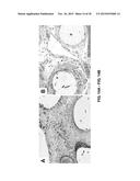 TOOTH SCAFFOLDS diagram and image