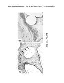 TOOTH SCAFFOLDS diagram and image