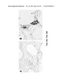 TOOTH SCAFFOLDS diagram and image