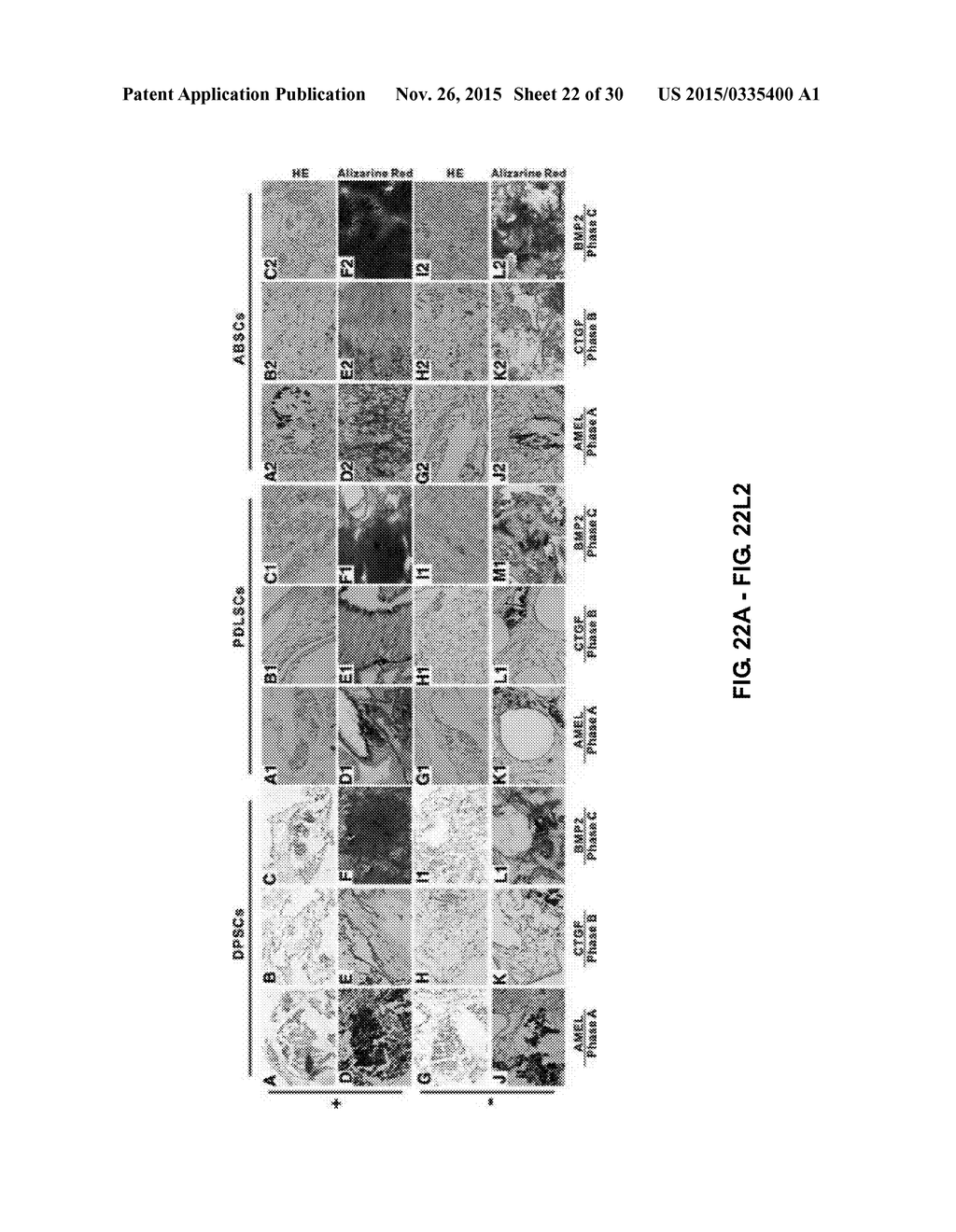 TOOTH SCAFFOLDS - diagram, schematic, and image 23